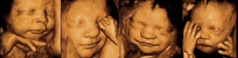 3D ultrasound Ohio header